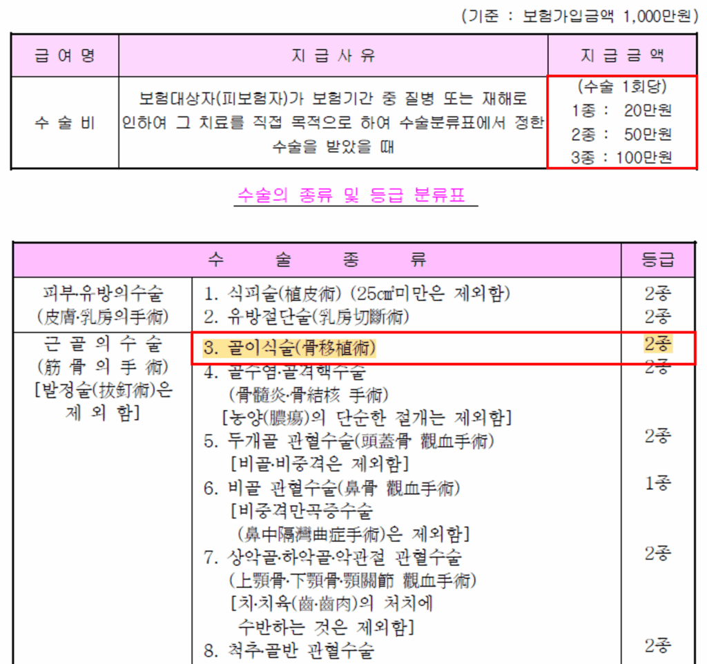 임플란트 치조골이식술이 골이식술 2종으로 분류된 1~3종 수술비 약관